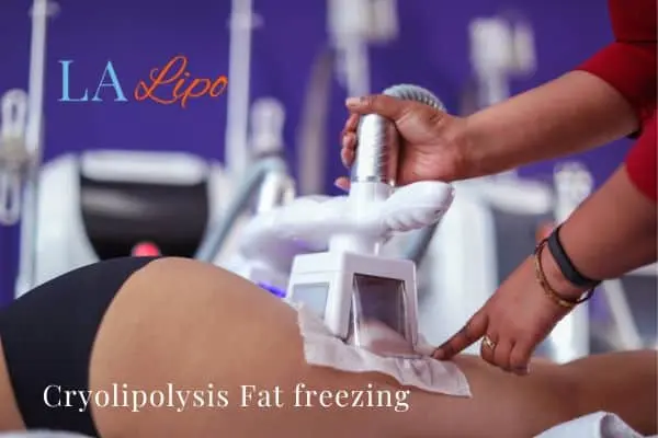 women getting fat freezing Enfield Highway