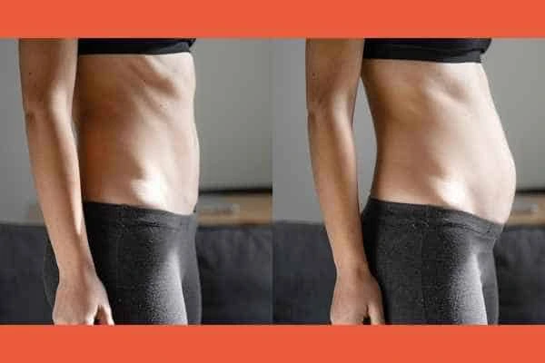 LA-EMS Body Sculpting results Enfield Highway