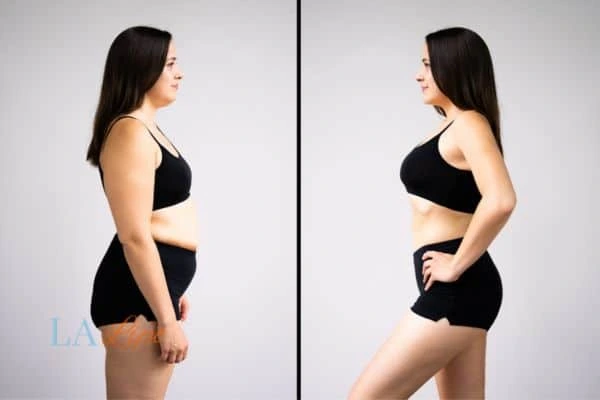 Picture of womans before and after using LA-EMS body sculpting to improve her core strength Enfield Highway