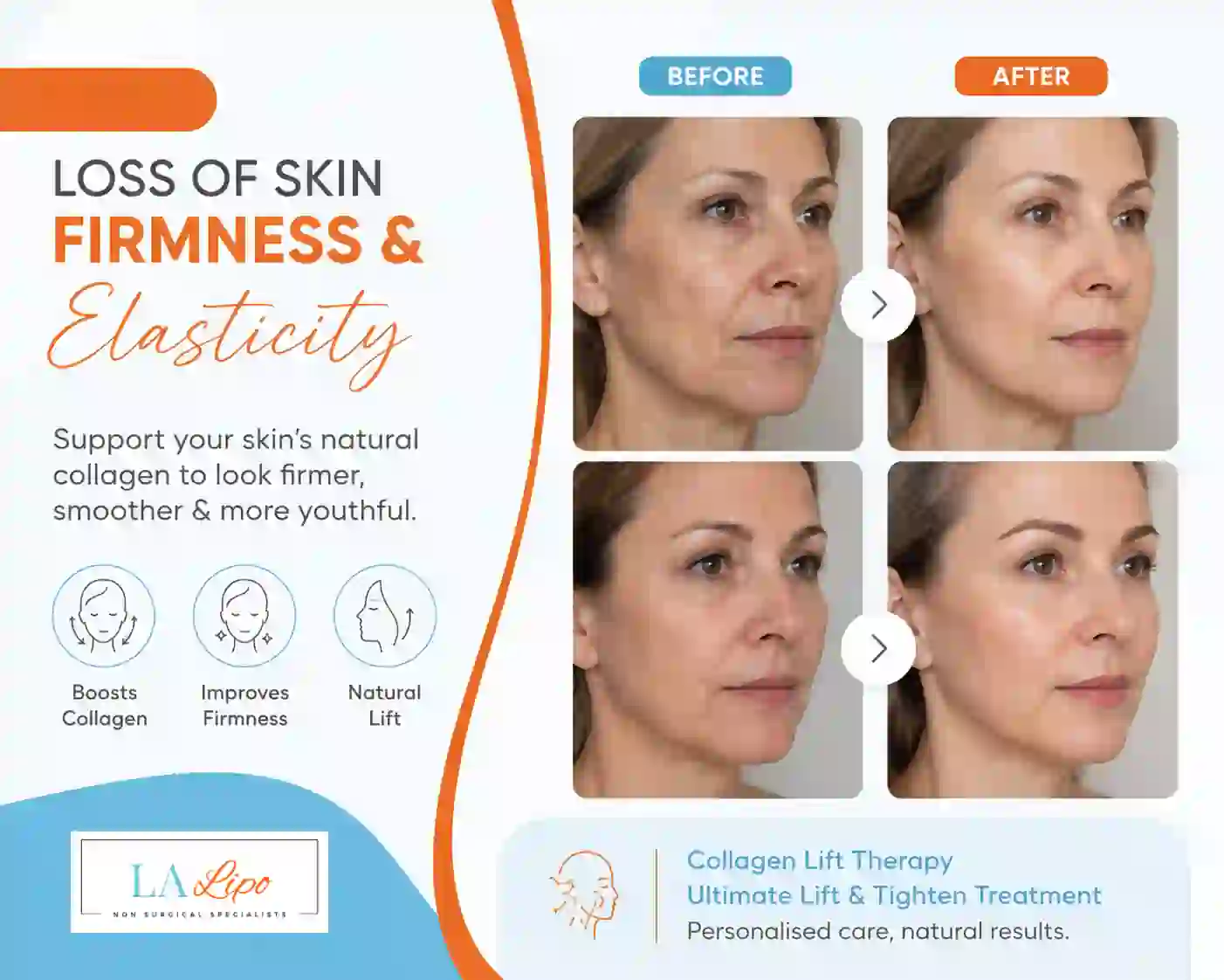 Sign #7: Loss of Skin Firmness and Elasticity Enfield Highway