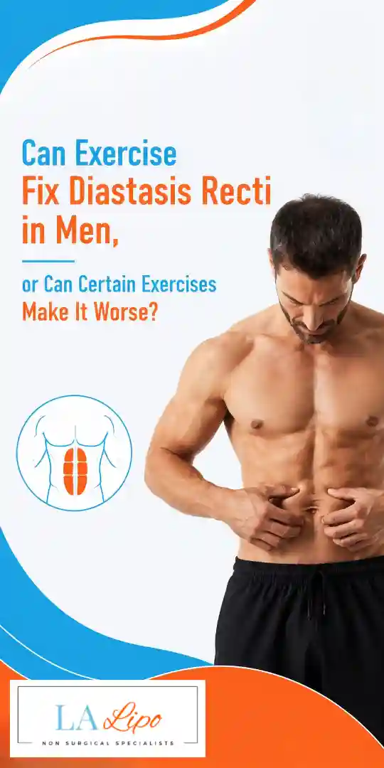 Can Exercise Fix Diastasis Recti in Men, or Can Certain Exercises Make It Worse Enfield Highway?